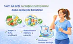 Cum să eviți carențele nutriționale după operațiile bariatrice